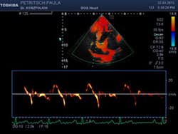 Bildschirmaufnahme einer Gewebedoppler-Analyse